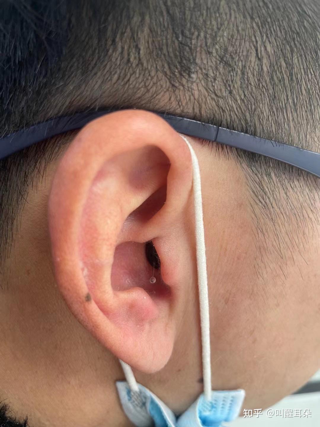 新款神逸iic助听器