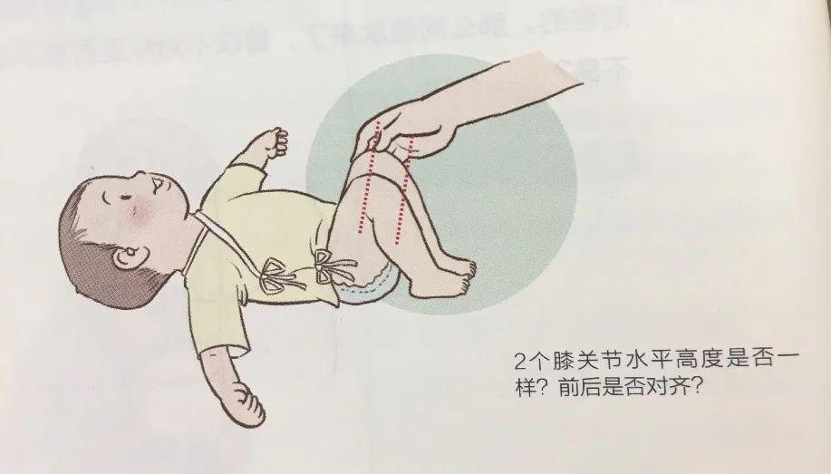 婴儿大腿外侧注射图片图片