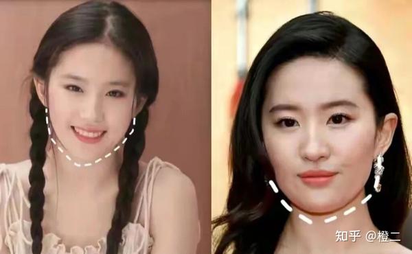 脸变大发腮怎么解决?不同类型的发腮解决攻略请你收好(附发腮测试) - 知乎