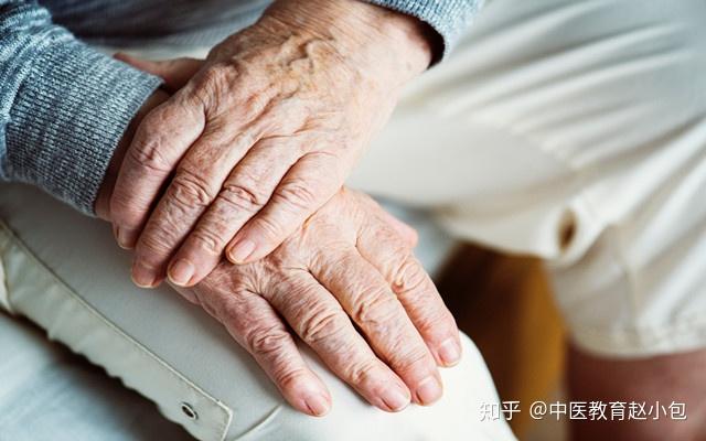 引起手麻的常见原因神经卡压症1腕管综症拇,食,中指的麻木疼痛,常有