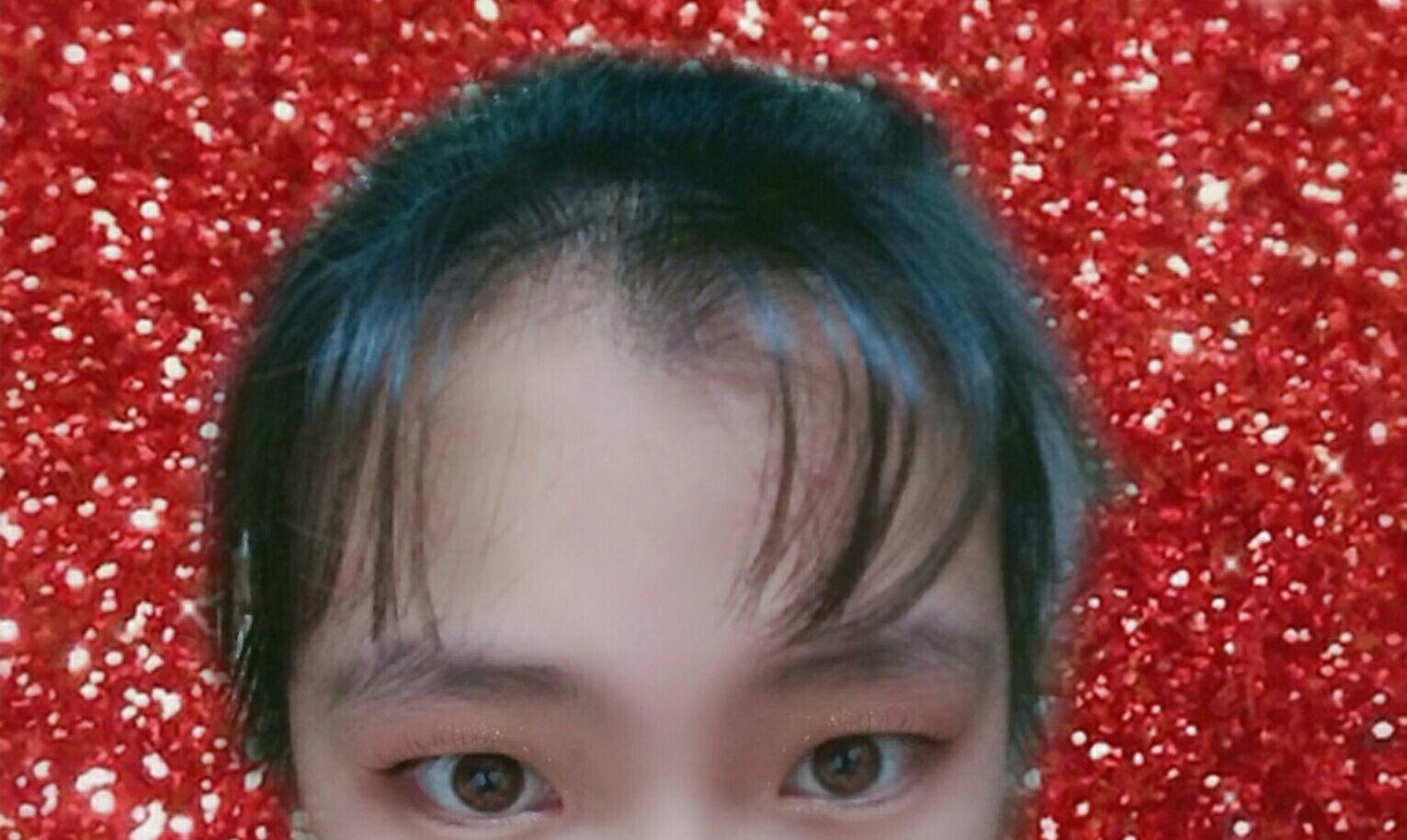 发际线有旋怎么留刘海?