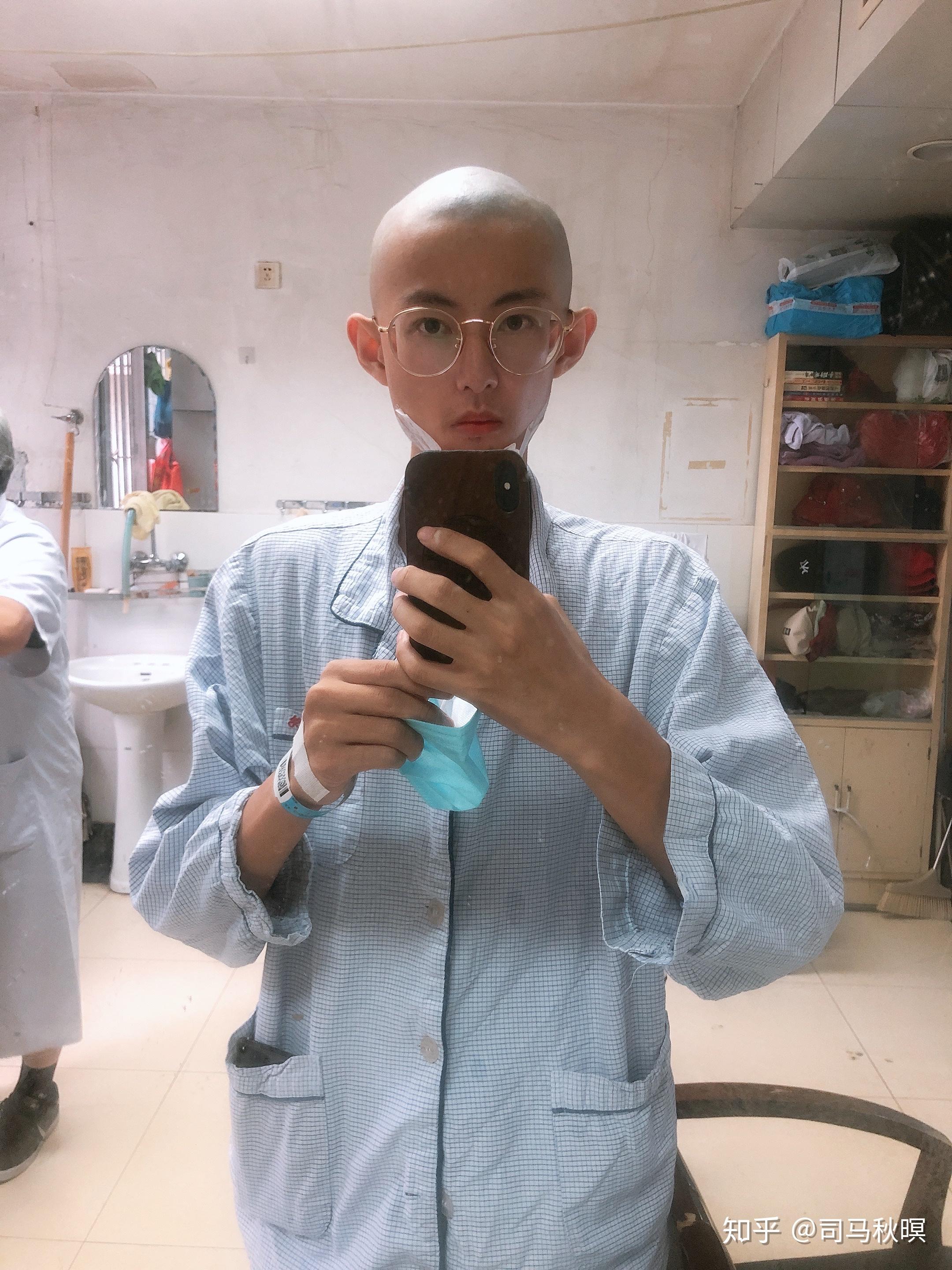 因为是要在脸上开刀,所以要剃光头.