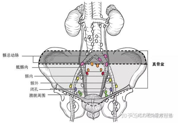 一文读懂膀胱癌的tnm分期 知乎