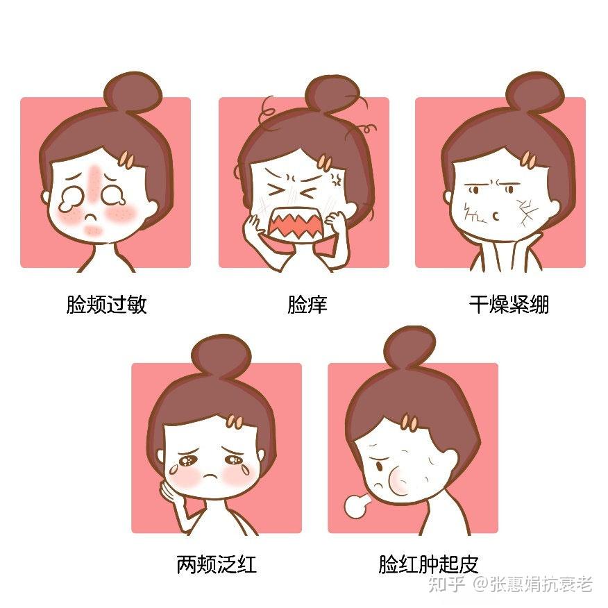 张惠娟抗衰如何应对春季皮肤过敏