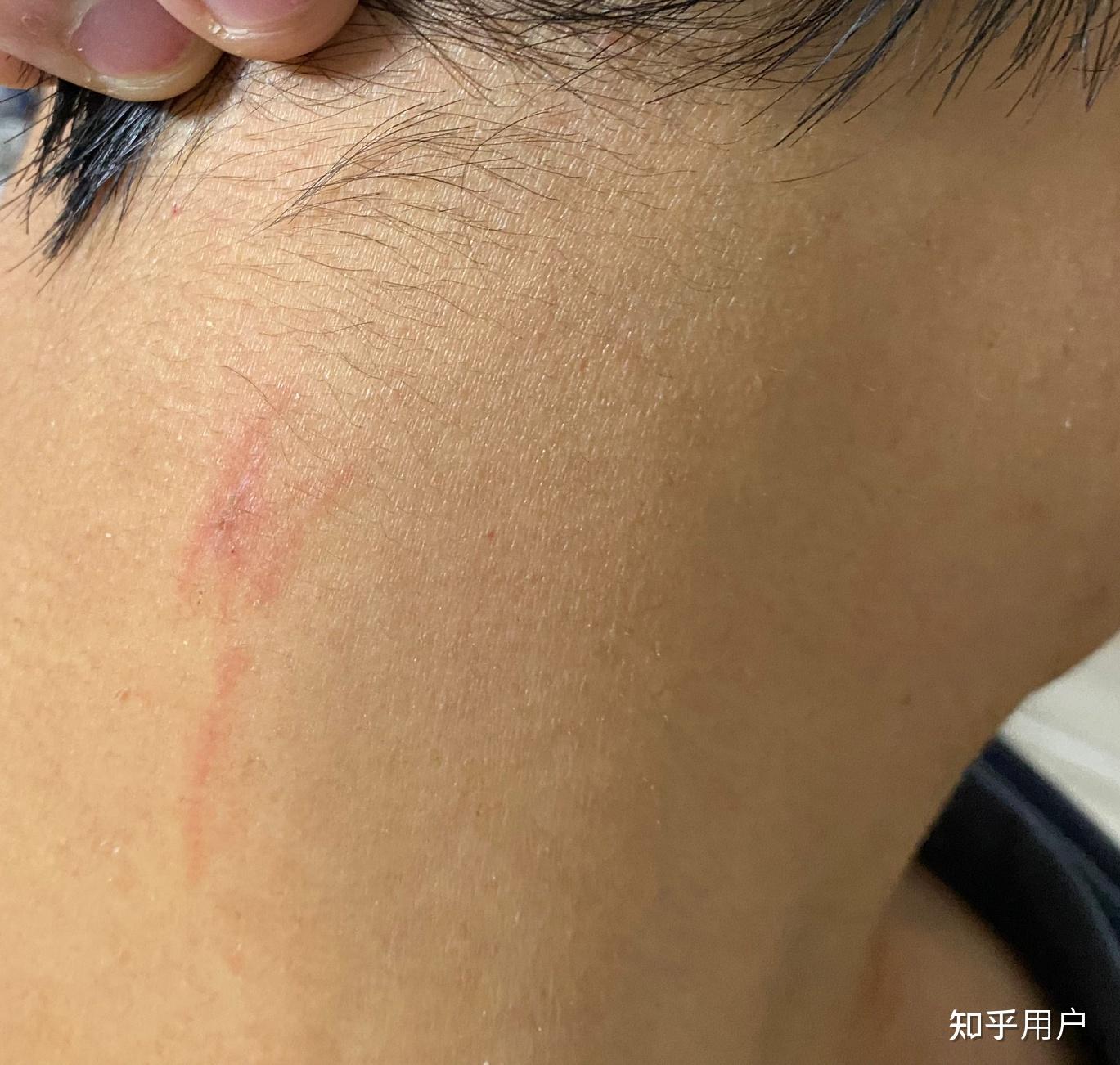 今天身上再次出现莫名划痕求解