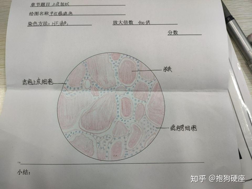 甲状腺滤泡单层立方上皮细胞仅供参考,嘻嘻126 人赞同了该文章医学生.