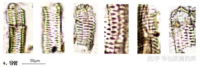 孔纹导管显微图图片