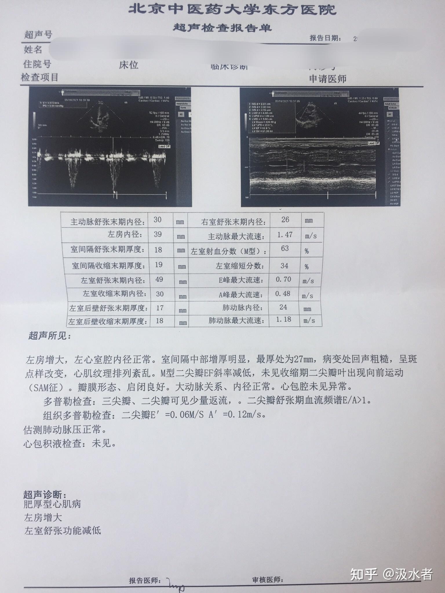 肥厚型心肌病非梗阻考教师体检