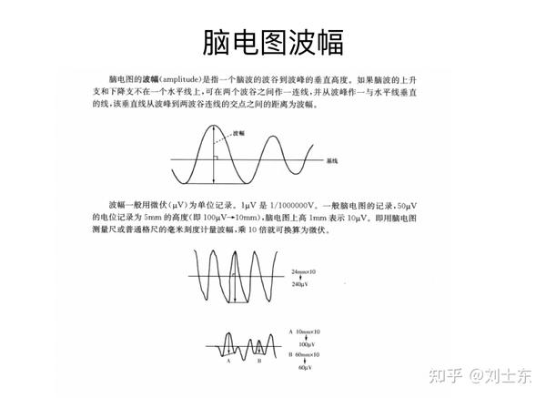 儿童脑电图基础与判读解析 知乎