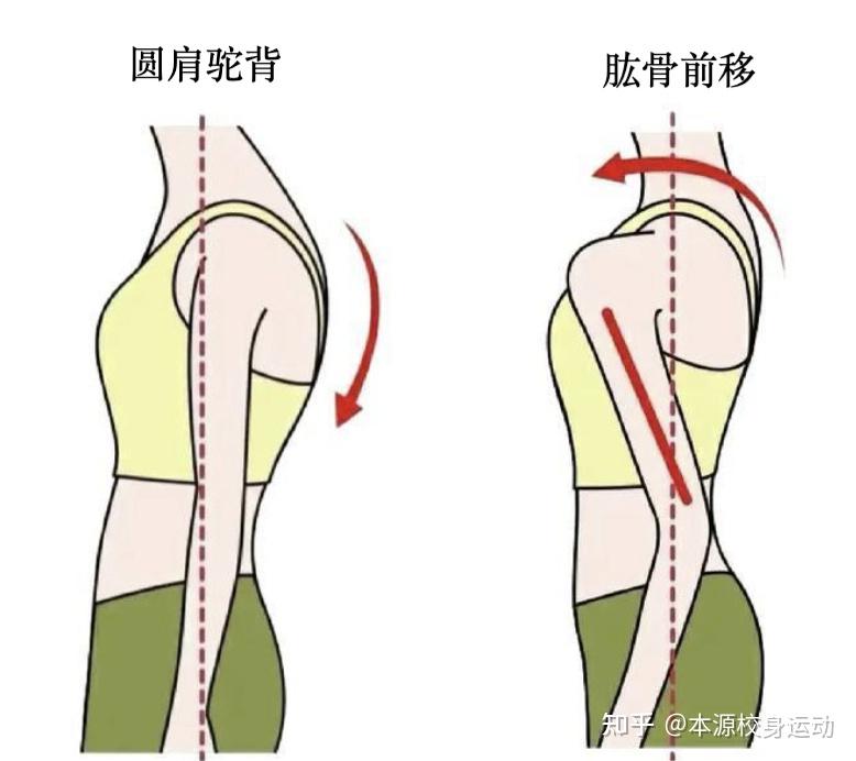 以为把肩练大了，其实是肱骨前移！不靠拉伸怎么救 - 知乎