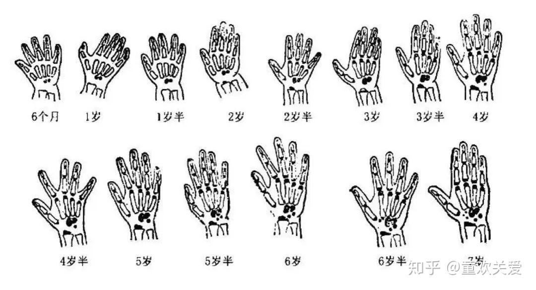 在人体骨骼发育过程中,骨化中心出现的时间,骨化速度和骨骺与干骺端