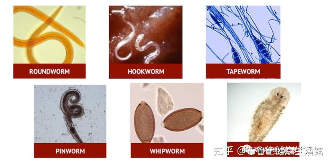 99%的人都不知道自己身体里的寄生虫,附驱虫方法! - 知乎