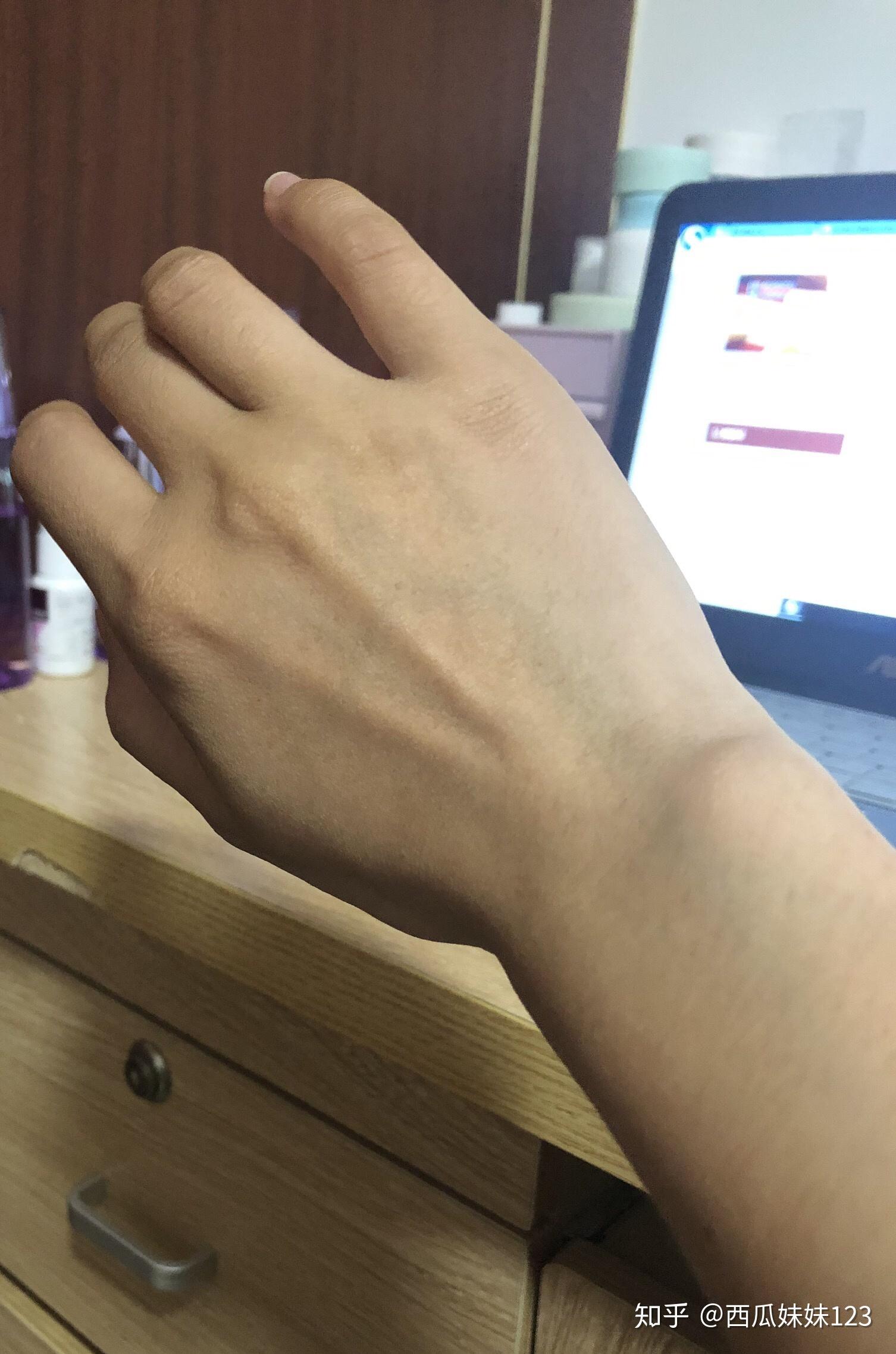 手为什么很黄? - 知乎