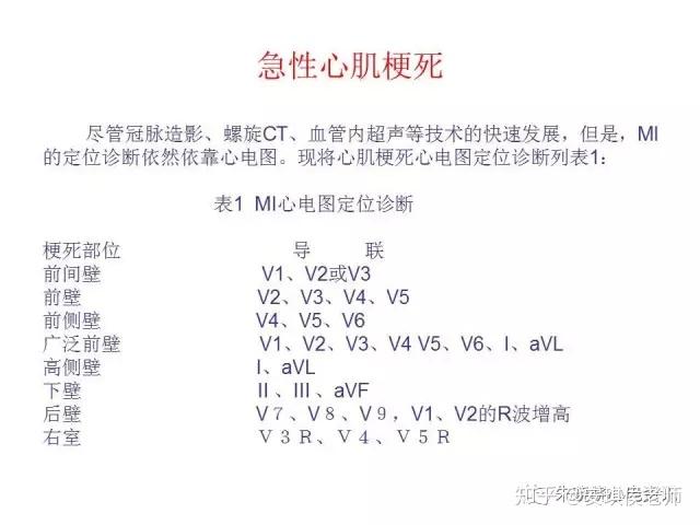 v2-58a80bf7567c2115230c57d967cfd556_r.jpg