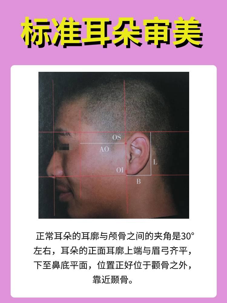 景丽峰医生解读贴发耳和精灵耳对颜值影响有多大