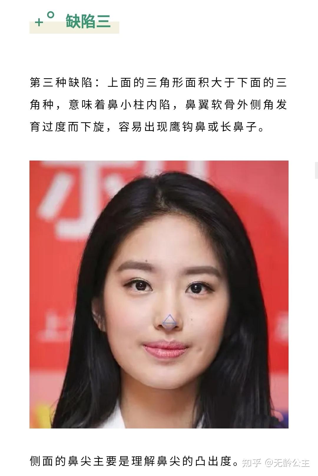 如果你无法形成两个等边三角形,就代表你的鼻尖形态存在某种程度的