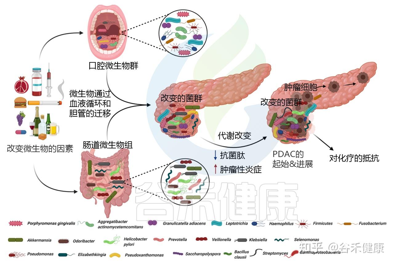 隱藏高手胰腺癌的新出路微生物