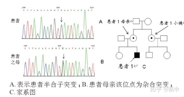 经过gla基因测序发现患者存在ivs 6 3a>g剪接位点突变(半合子);患者