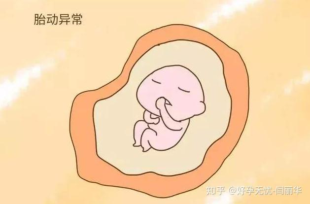 产检时明明好好的,怎么就突然胎停了? - 知乎