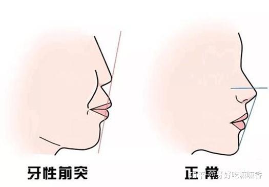 v2-59420d30782ce548b33eca448894a16e_r.jpg