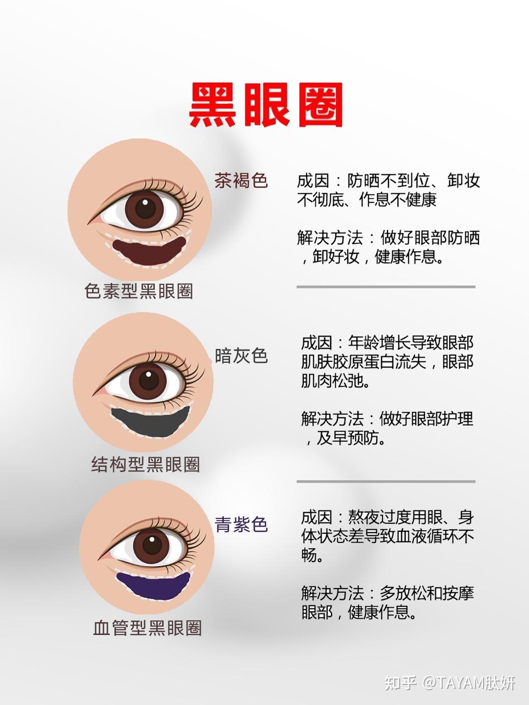 你是哪种类型的眼部问题呢?