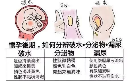 怀孕破水和漏尿如何区分(孕期怎样区分漏尿和破水)漏尿还是轻微破水