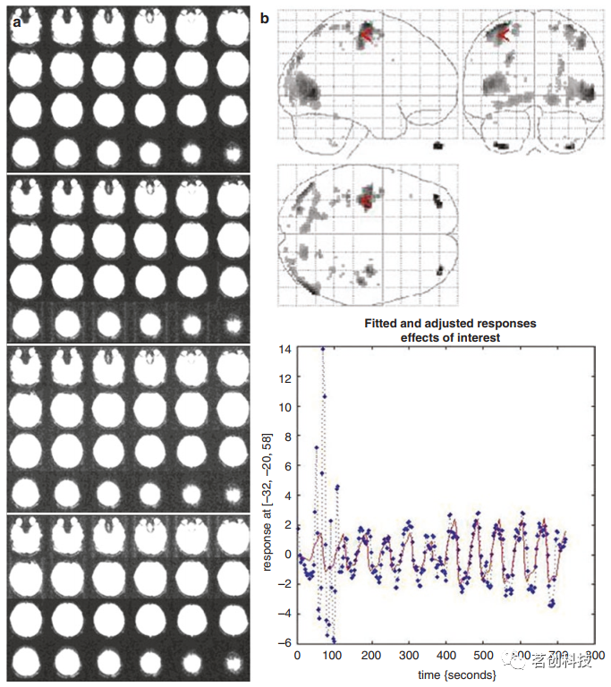 BOLD fMRI和DTI：伪影、技巧和诀窍 - 知乎