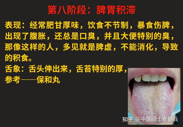 脾气虚、脾阳虚,由轻到重,看看自己的脾虚在哪个阶段?12个阶段的脾虚一次讲明白 - 知乎
