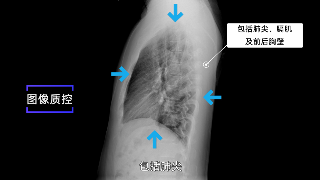 胸腰段正侧位中心线图片