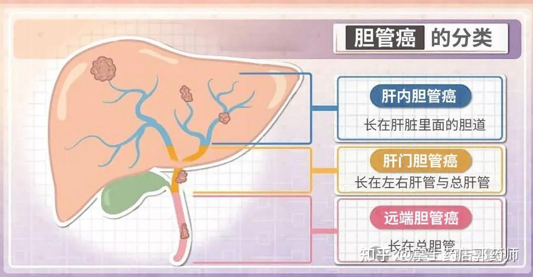 胆管癌靶向治疗药物有哪些?