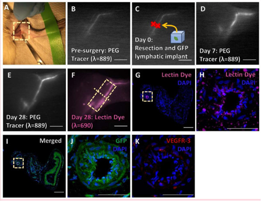 hydrogels engineered to promote collecting lymphatic vessel