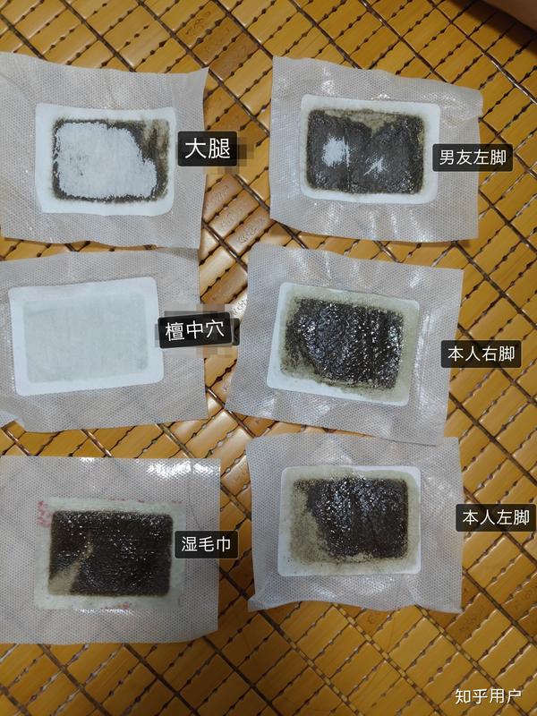 足贴排湿气贴哪里图片祛湿贴贴多久后用足贴贴出来黑黑的东西是湿气吗