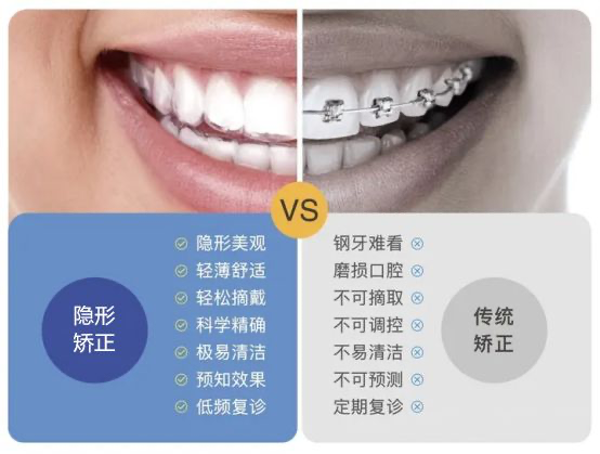 为什么要选择做隐形矫正牙齿隐形矫正的好处是什么呢