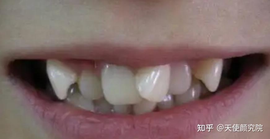 郑秀妍这段太蛊了吧!芒果台怎么能删了不播??!(郑秀妍签约英皇)