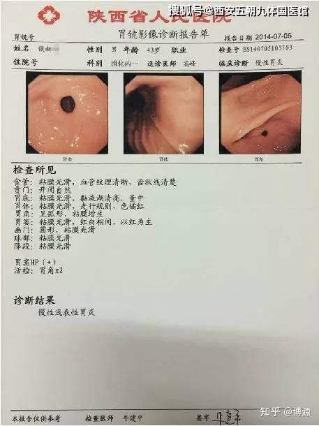 李学武脾胃病专家团队逆转萎缩性胃炎肠化异型增生成功案例分享