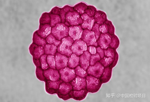 人乳头瘤病毒igm抗体检测试剂说明书