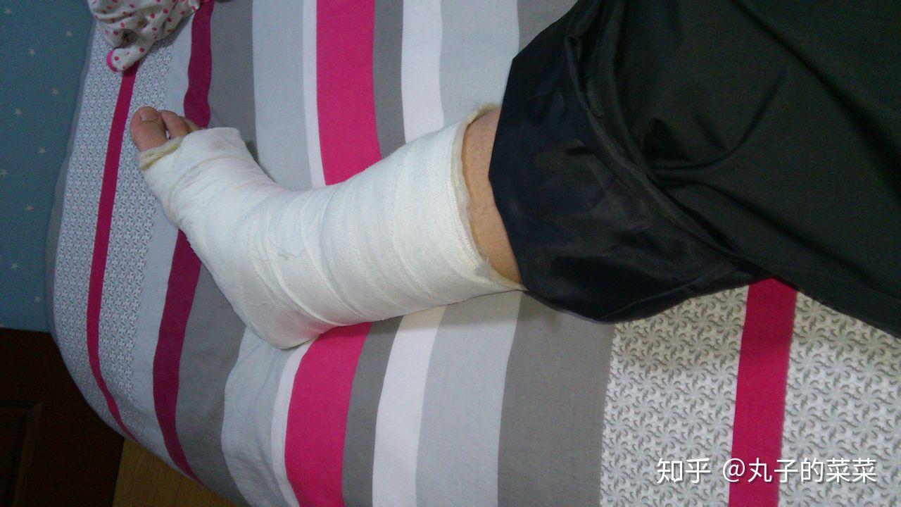 致使增加了骨的脆性,导致易于发生骨折的一种全身性代谢疾病