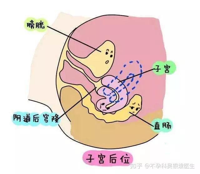 哪些子宫性疾病会影响怀孕