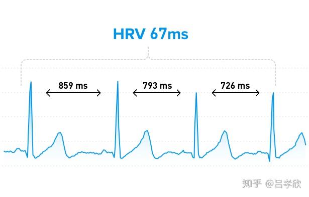 HRV hrv