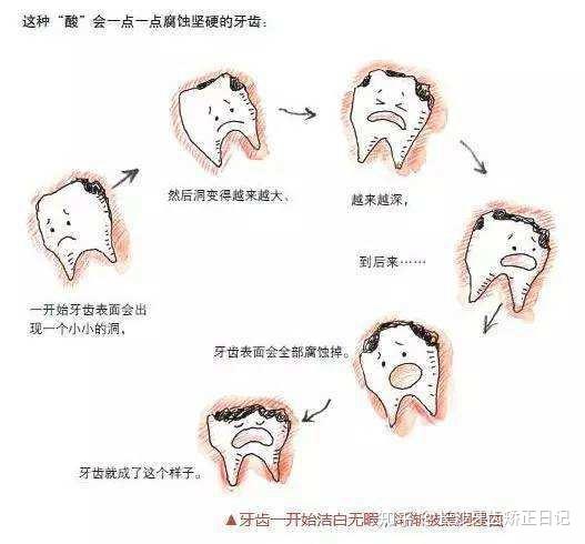 牙疼稽延诊治住进icu 酿ray雷竞技app成牙疼起因有哪些