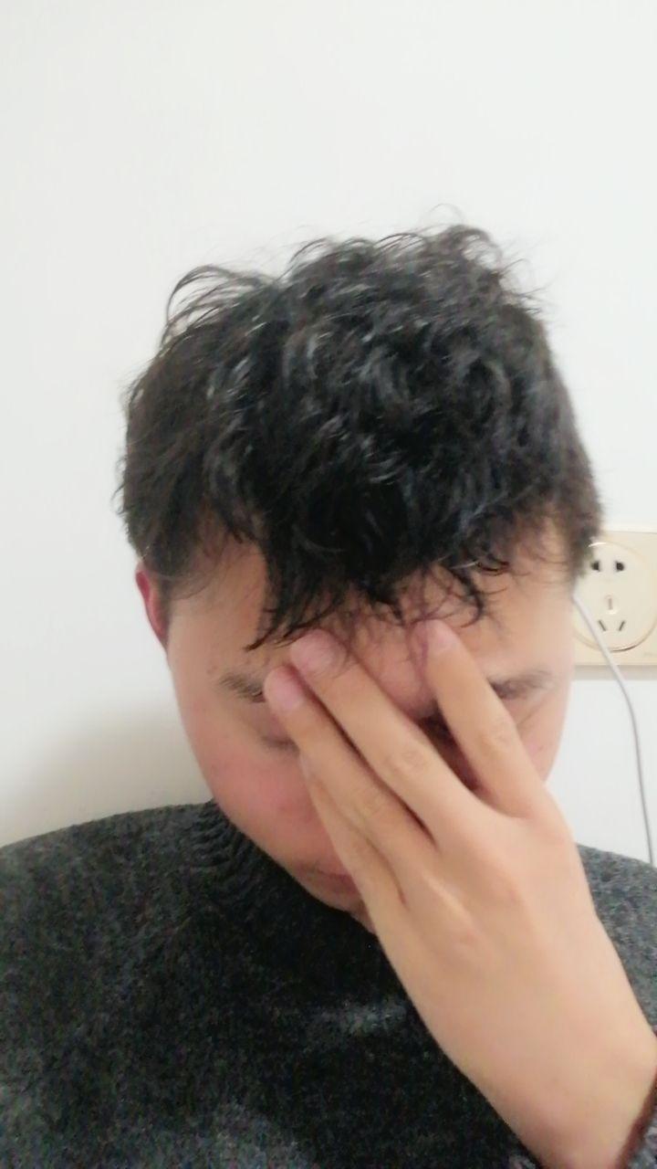 我这是要秃顶吗╯﹏╰两边头发很少怎么办有方法让他长多点吗