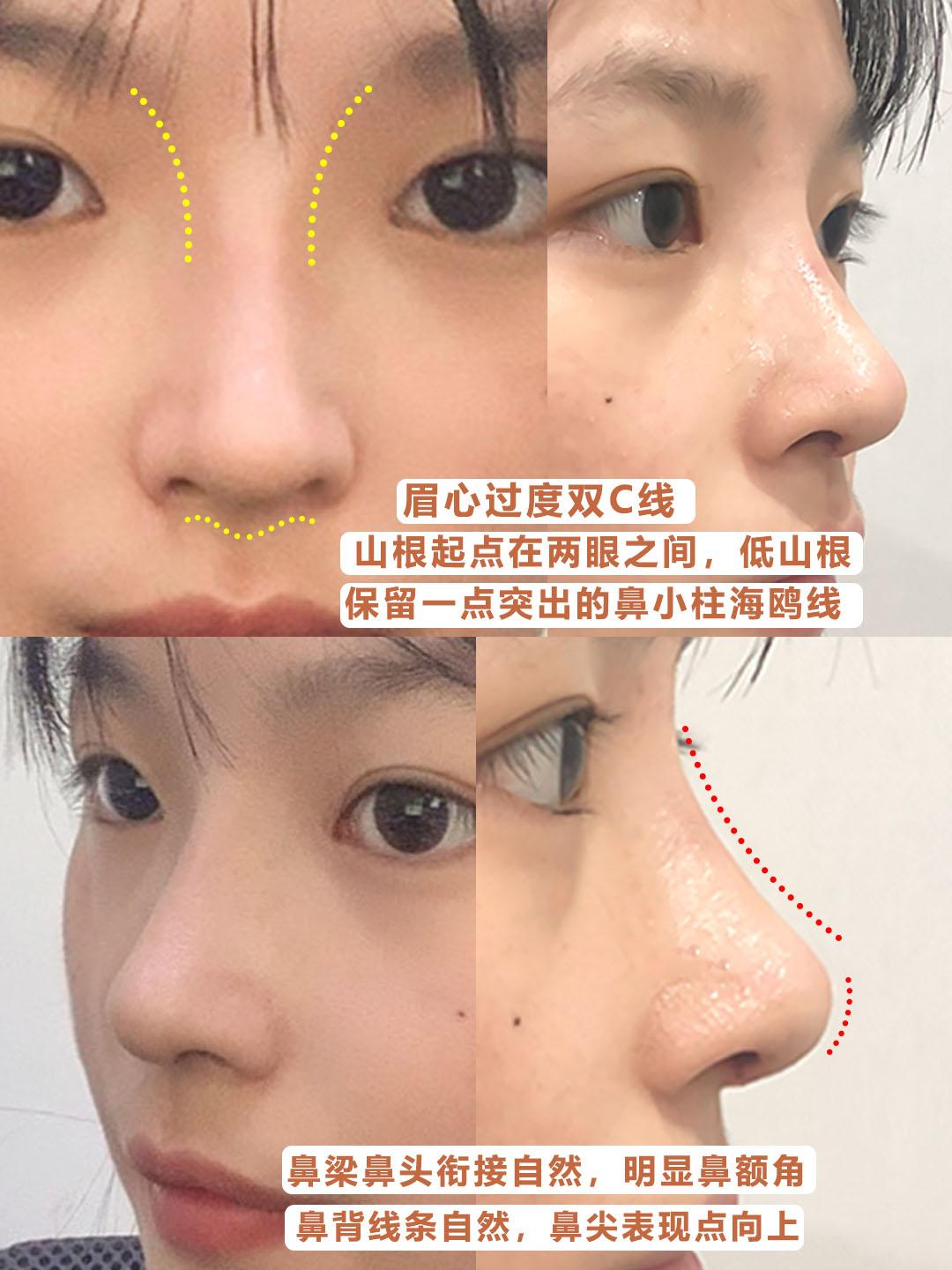 鼻型审美功课 知乎