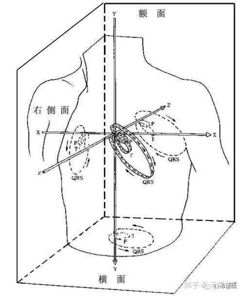 心的体表投影怎么画图片