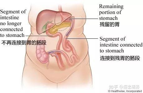 减肥药物有哪些_药物减肥_经期为什么不能吃减肥药物