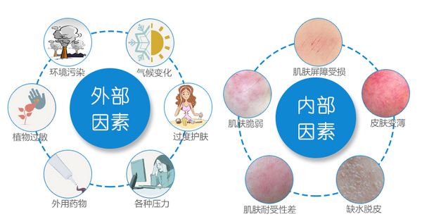 三分钟了解敏感肌 什么是敏感肌 敏感肌又是如何形成的 知乎