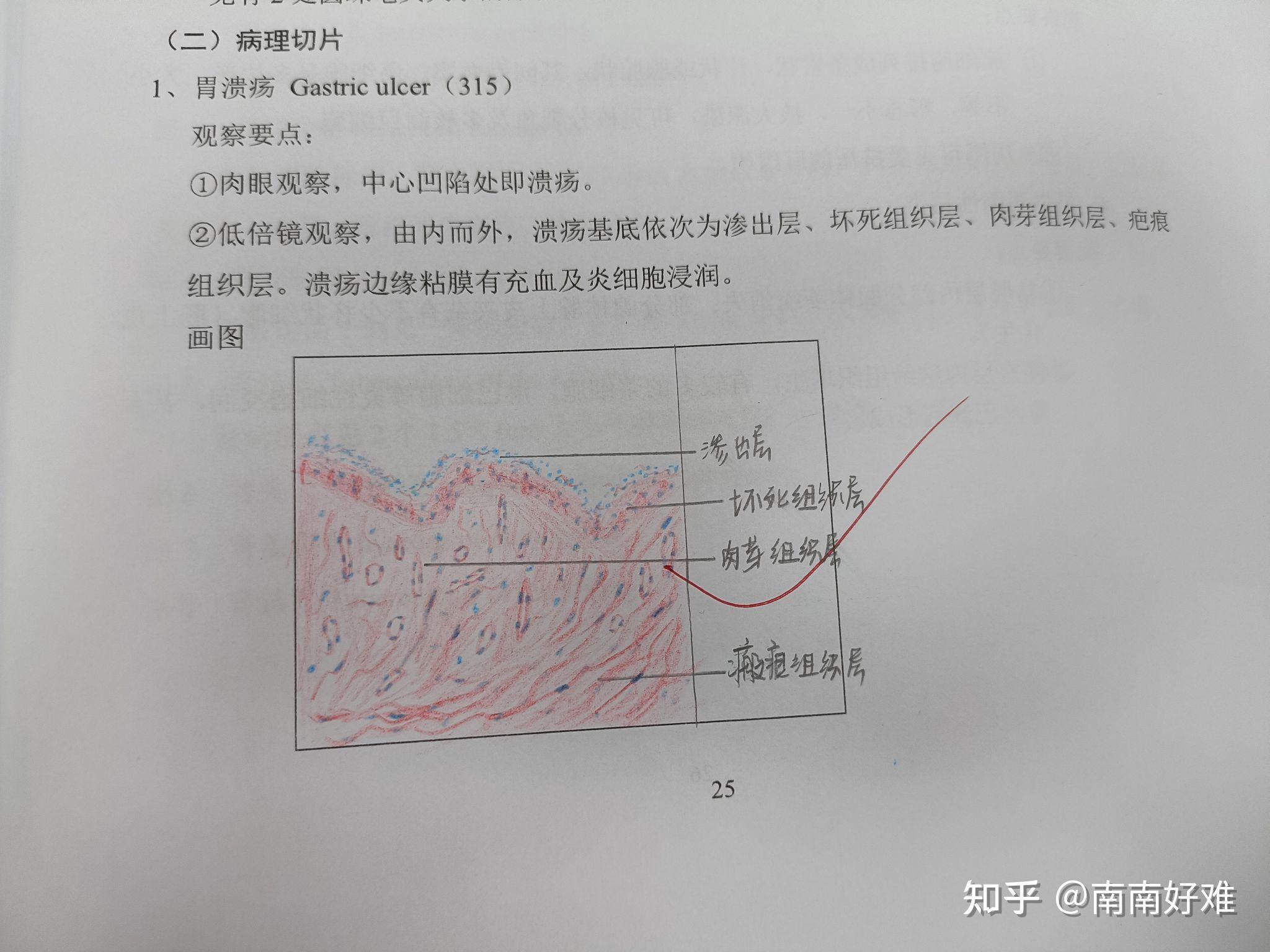 病生实验报告红蓝铅笔图