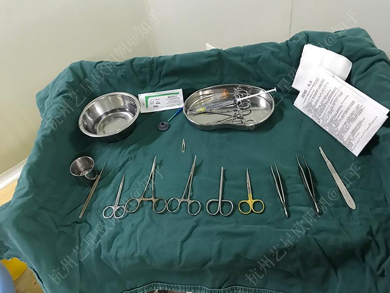 做双眼皮手术是怎样的一种体验