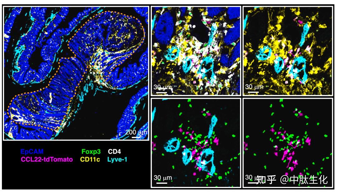 Cancer Cell丨毛开睿团队空间解析肿瘤抑制性免疫微环境 - 知乎
