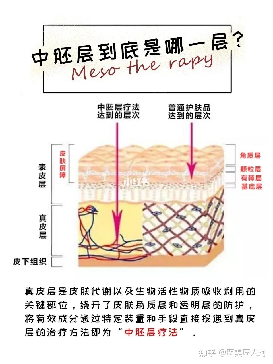 关于中胚层疗法你需要了解这些