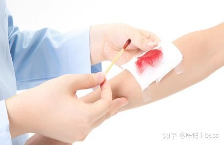 户外旅游发生跌打损伤 止血工作该怎么做到位呢 止血的那些事 知乎